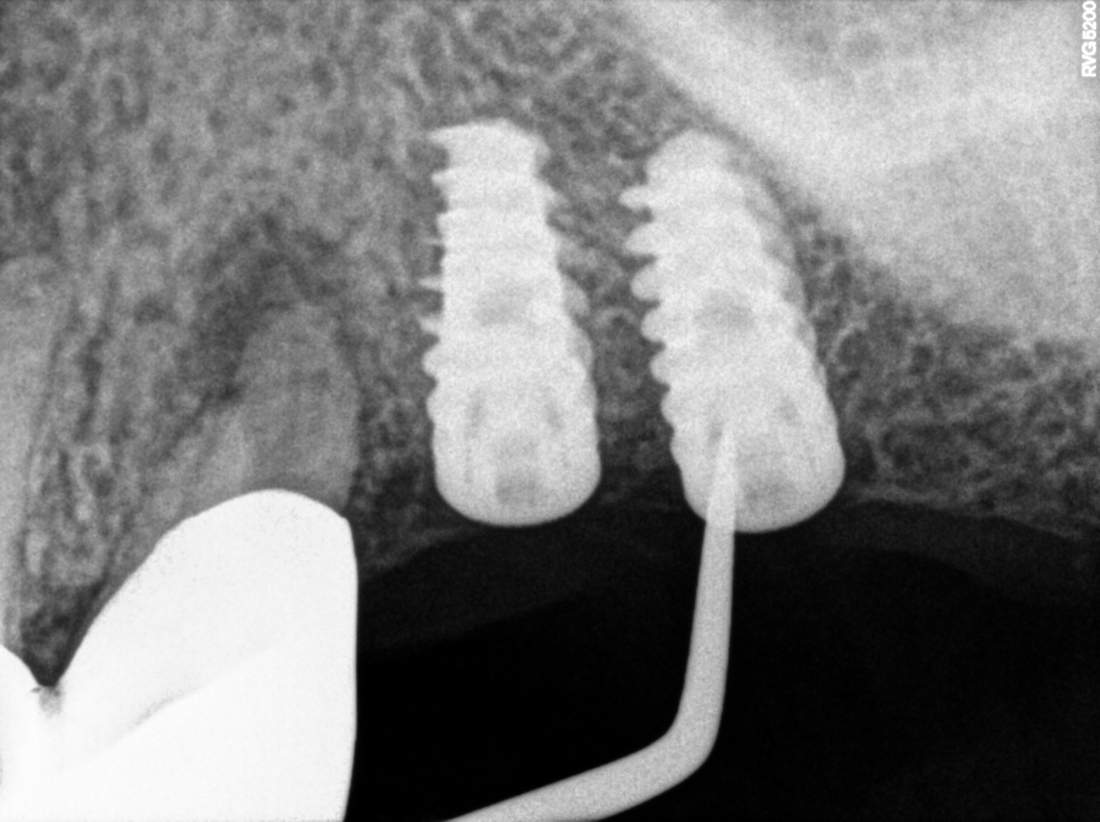 Dental X-ray